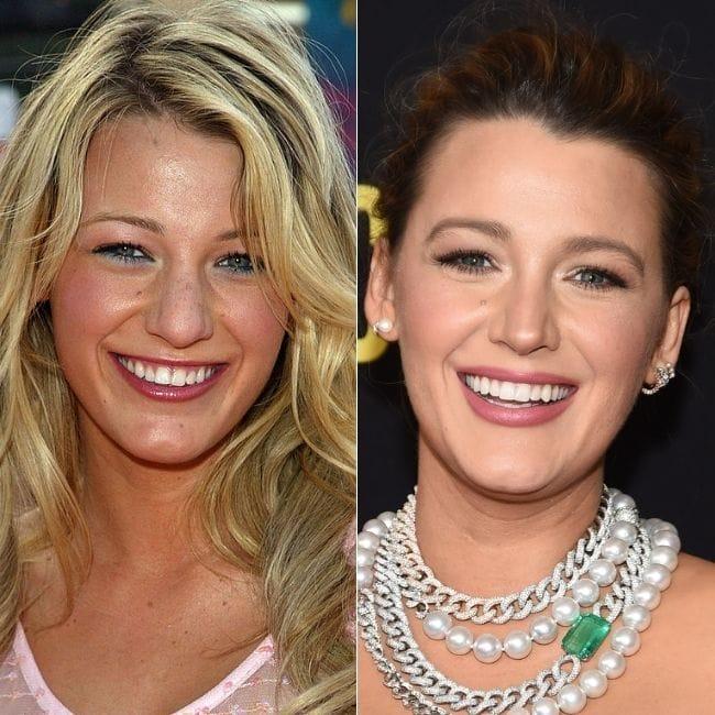 Blake Lively antes y después.