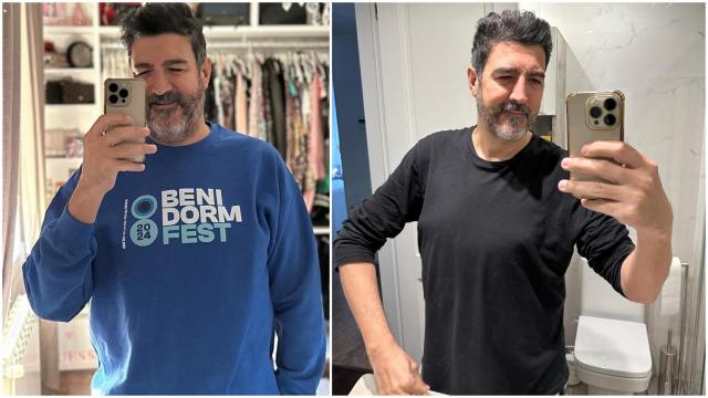 El presentador Tony Aguilar antes y después de su operación de estómago y esófago