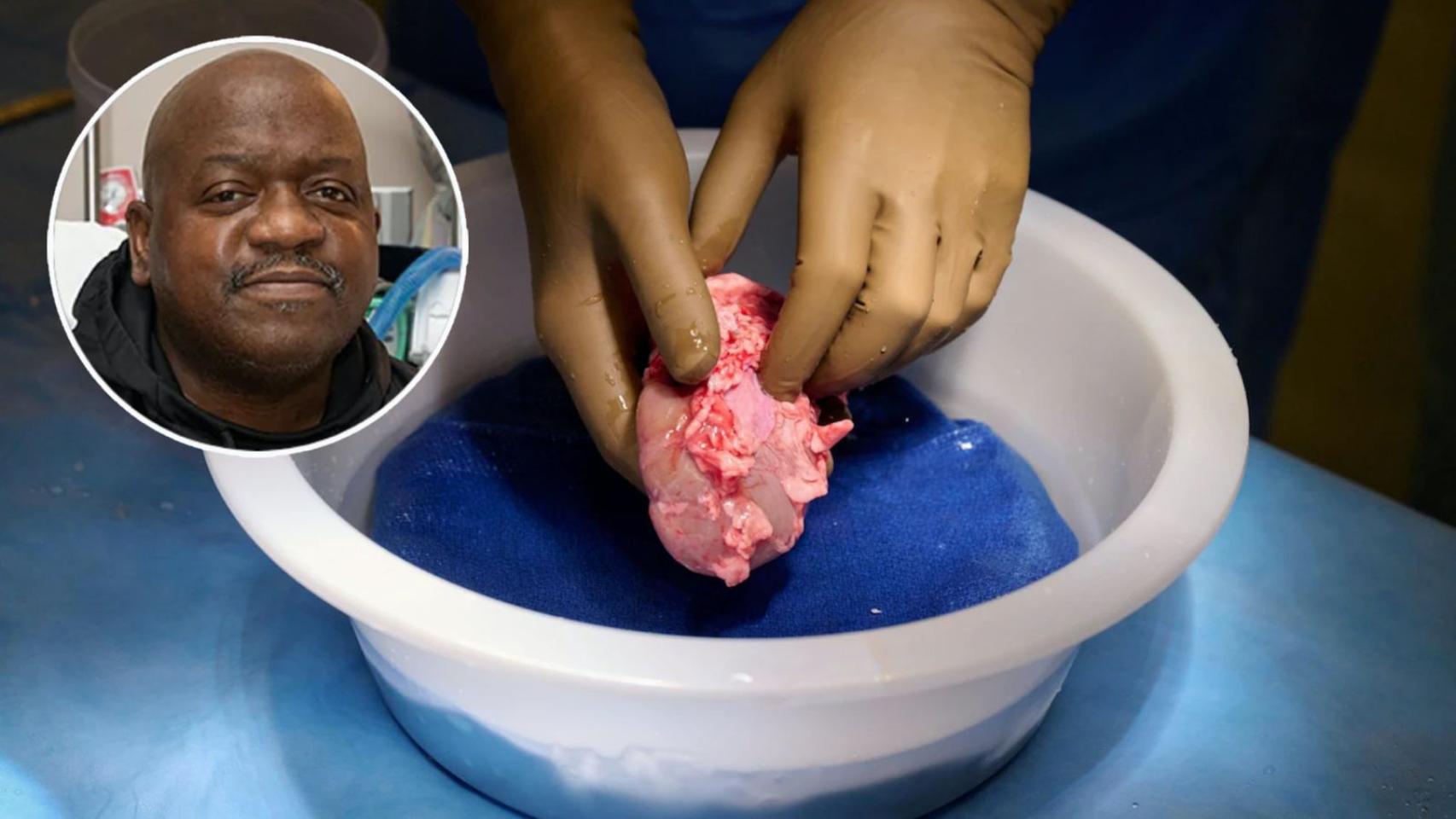 Rick Slayman falleció el pasado 11 de mayo tras vivir casi dos meses con un riñón de cerdo trasplantado.