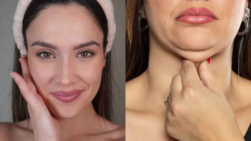 Ejemplo de cómo combatir la papada.