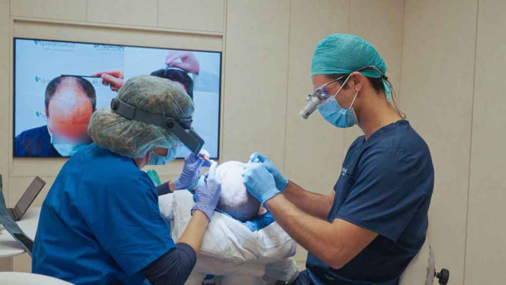 Un injerto capilar realizado por el Dr. Burgos.