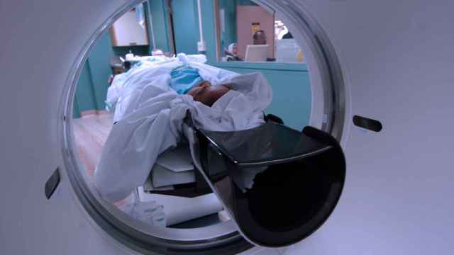 La tomografía o TAC es una de las pruebas de imagen que se utilizaría en el cribado del cáncer de pulmón.