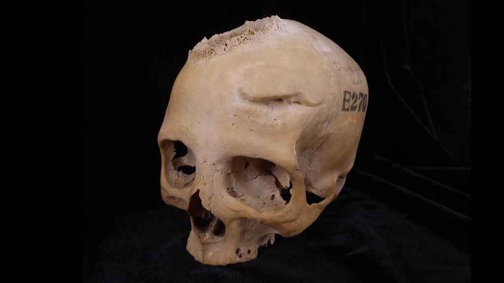 Cráneo de una mujer de más de 50 años dato entre 663-343 a.C.