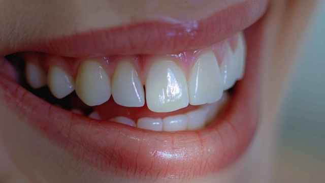 Elimina las manchas de tabaco en los dientes