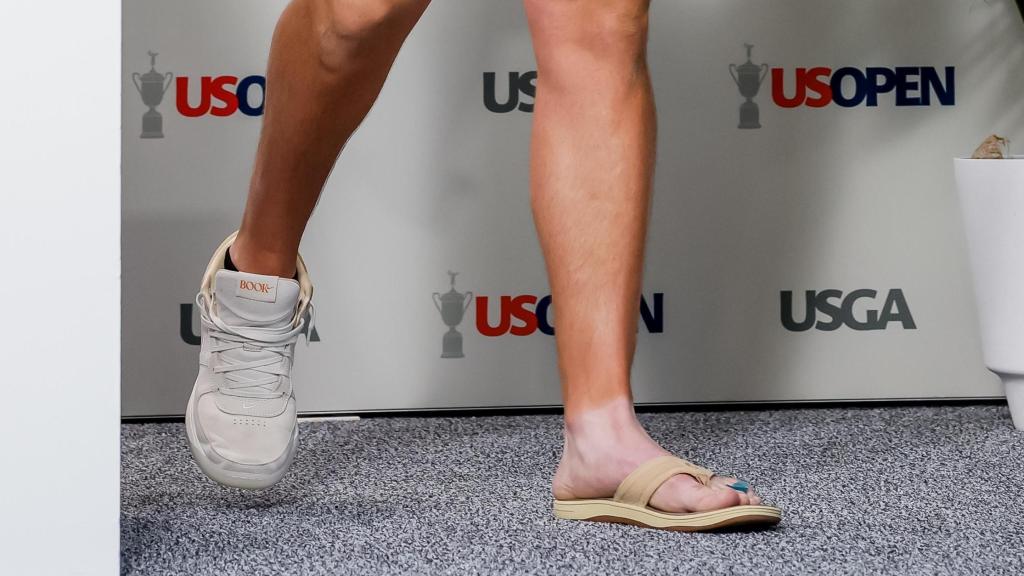 El pie de Jon Rahm tras sufrir una infección.