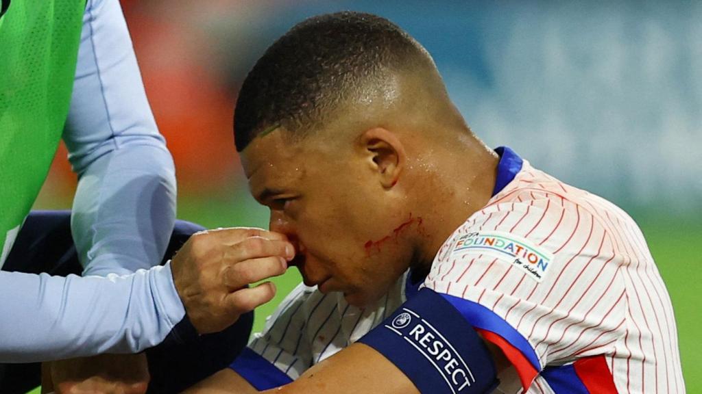 Los médicos de la selección francesa atienden a Kylian Mbappé