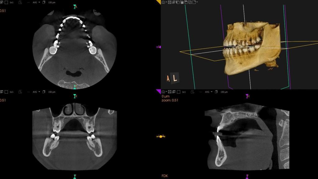 Una ortopantomografía.