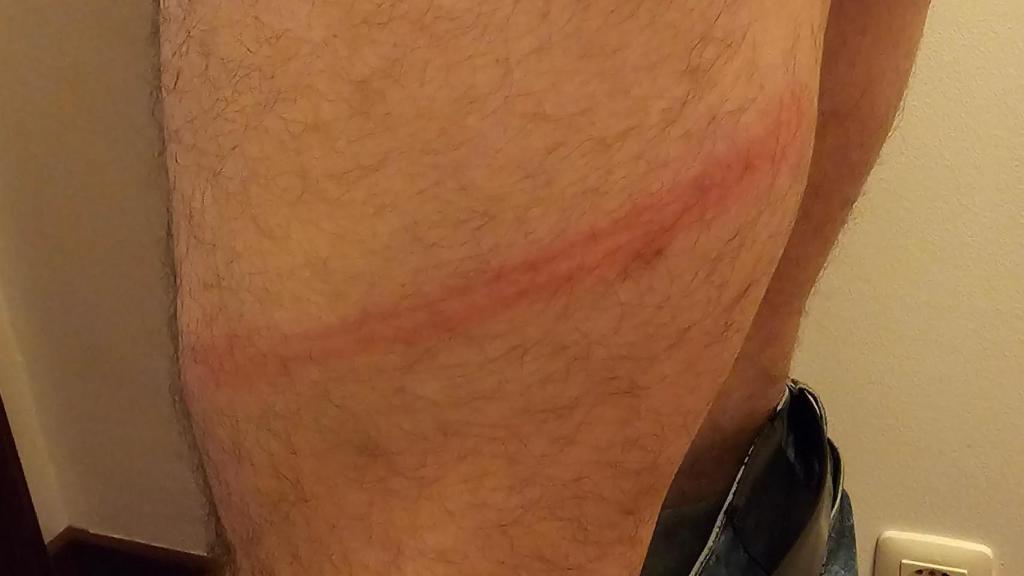 Marcas de Alberto Vázquez tras la paliza