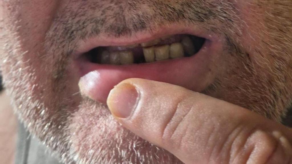 Lesiones producidas a un funcionario de la prisión de Zuera (Zaragoza).