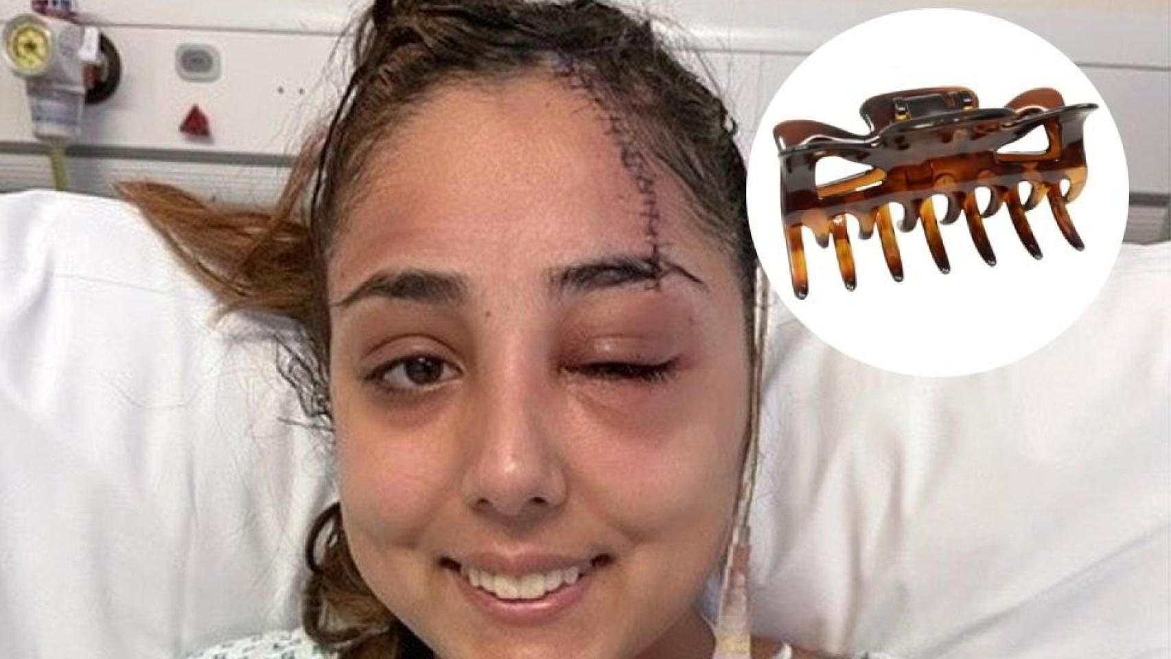 Jeena Panesar, superviviente de un accidente de tráfico en el que se clavó su pinza del pelo en el cráneo.