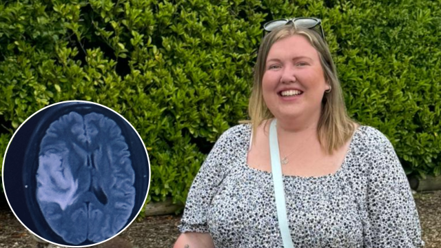 Kimberley Baggley compartió el escáner del astrocitoma que le diagnosticaron. The Brain Tumor Charity.