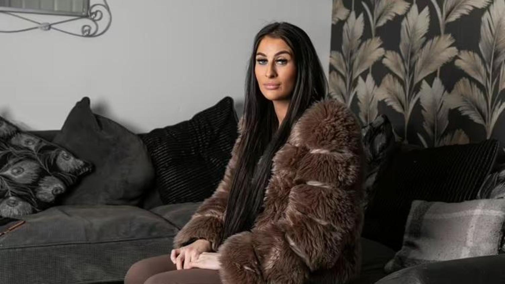 Kendall Bryce detalla cómo le condiciona esta alergia en su día a día. (SWNS)