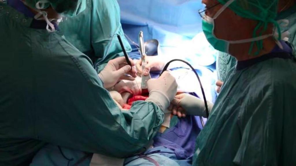 Intervención de un cáncer de páncreas.