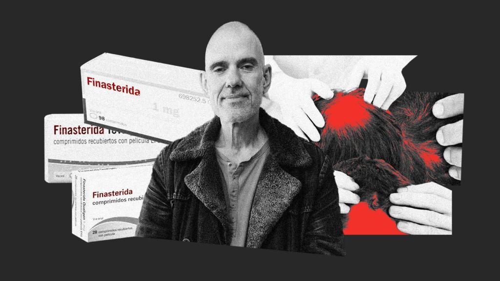 José Miguel ha tenido problemas cardíacos, digestivos y mentales tras tomar dos dosis completas de este fármaco.