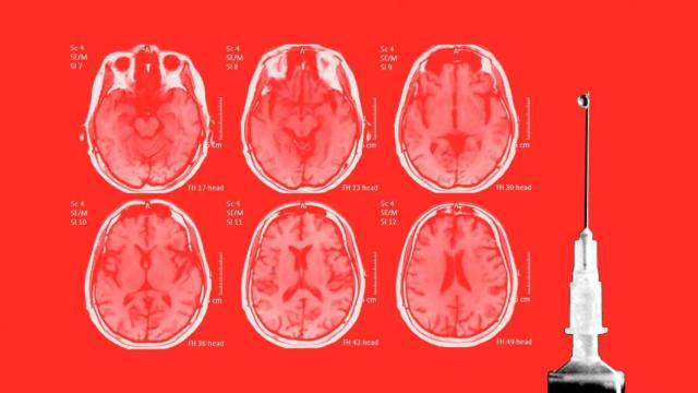 Se espera que este test llegue a Europa próximamente.