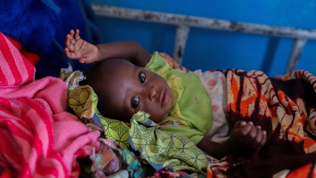 Los niños y niñas de Chad ven mermado su derecho a la alimentación.