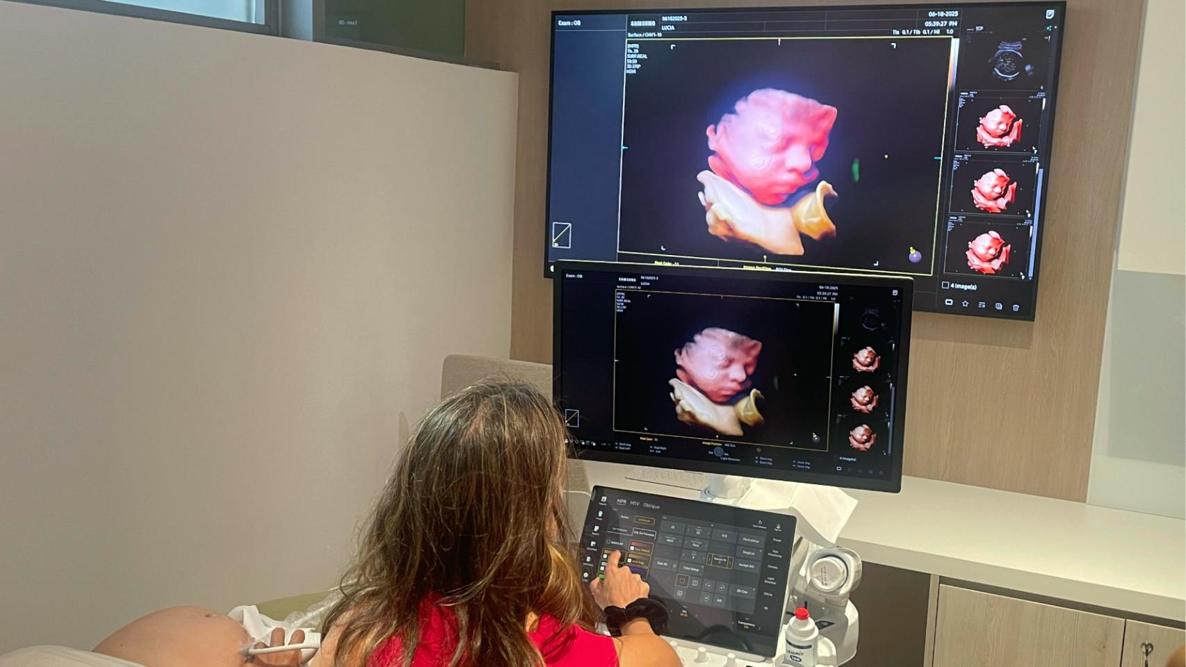 La doctora María del Mar Gil realizando una ecografía con el equipo Z20 de Samsung.