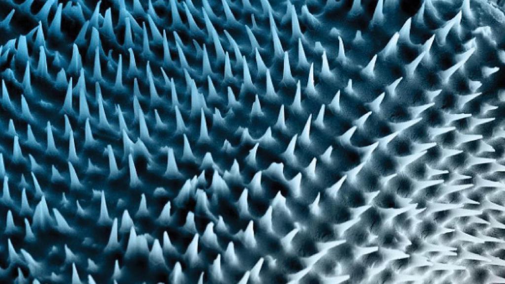 Vista ampliada de las nanoagujas