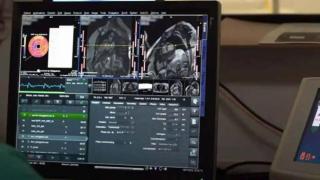 Crean una IA que supera a los médicos más experimentados: tiene cuatro veces más aciertos en diagnósticos complejos