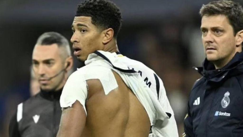 Jude Bellingham, con un aparatoso vendaje en el hombro izquierdo.