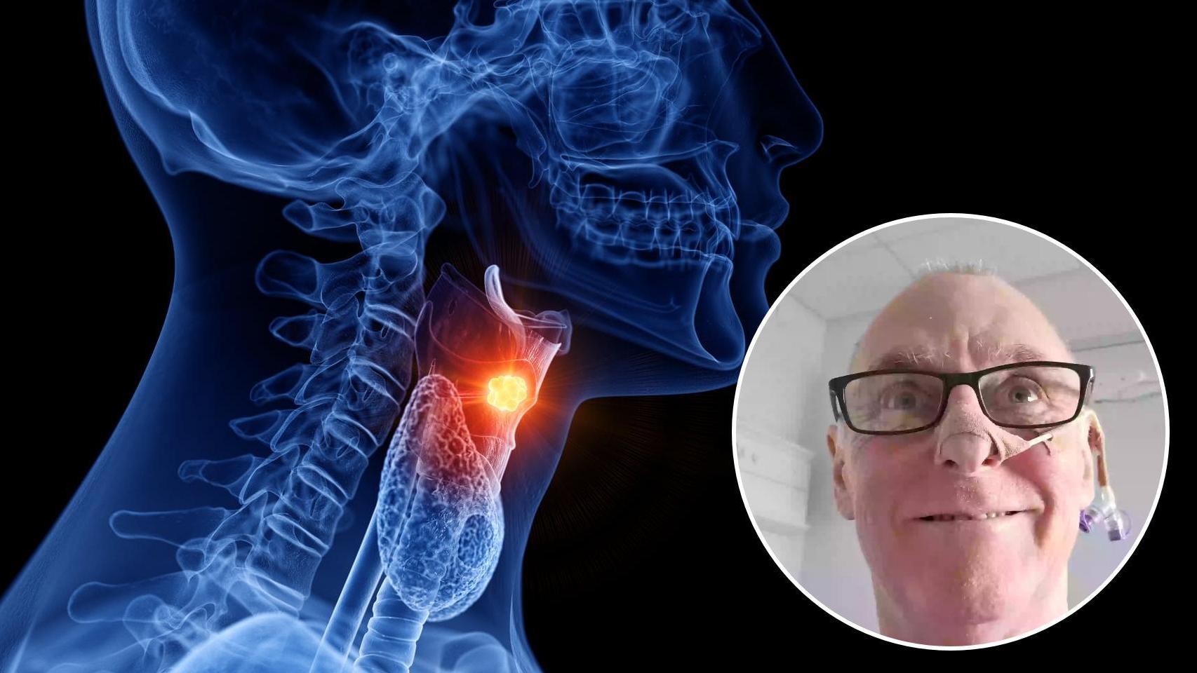 Frank contrajo el virus del papiloma humano por prácticas de riesgo,