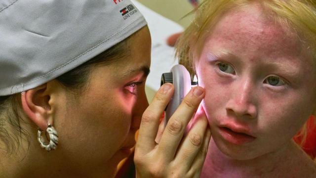 Una dermatóloga examina a una niña con albinismo afectada por quemaduras solares. La mayoría de los pacientes nunca había recibido atención médica especializada.