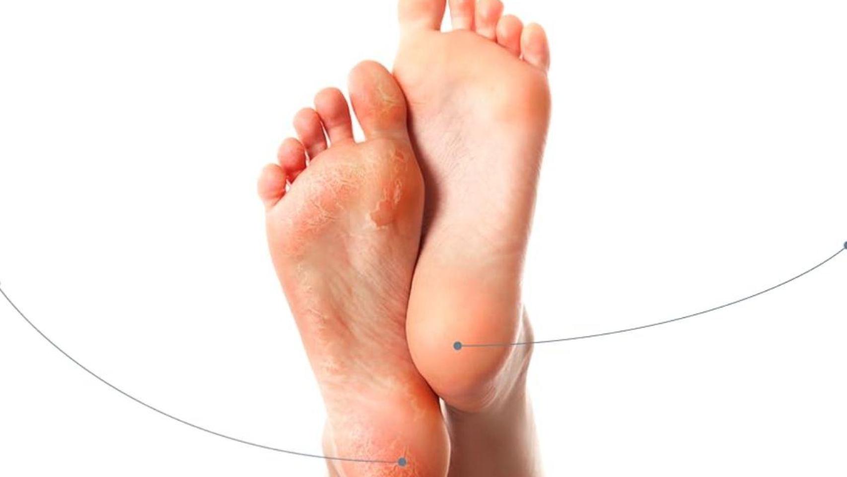 lima eléctrica de Essy