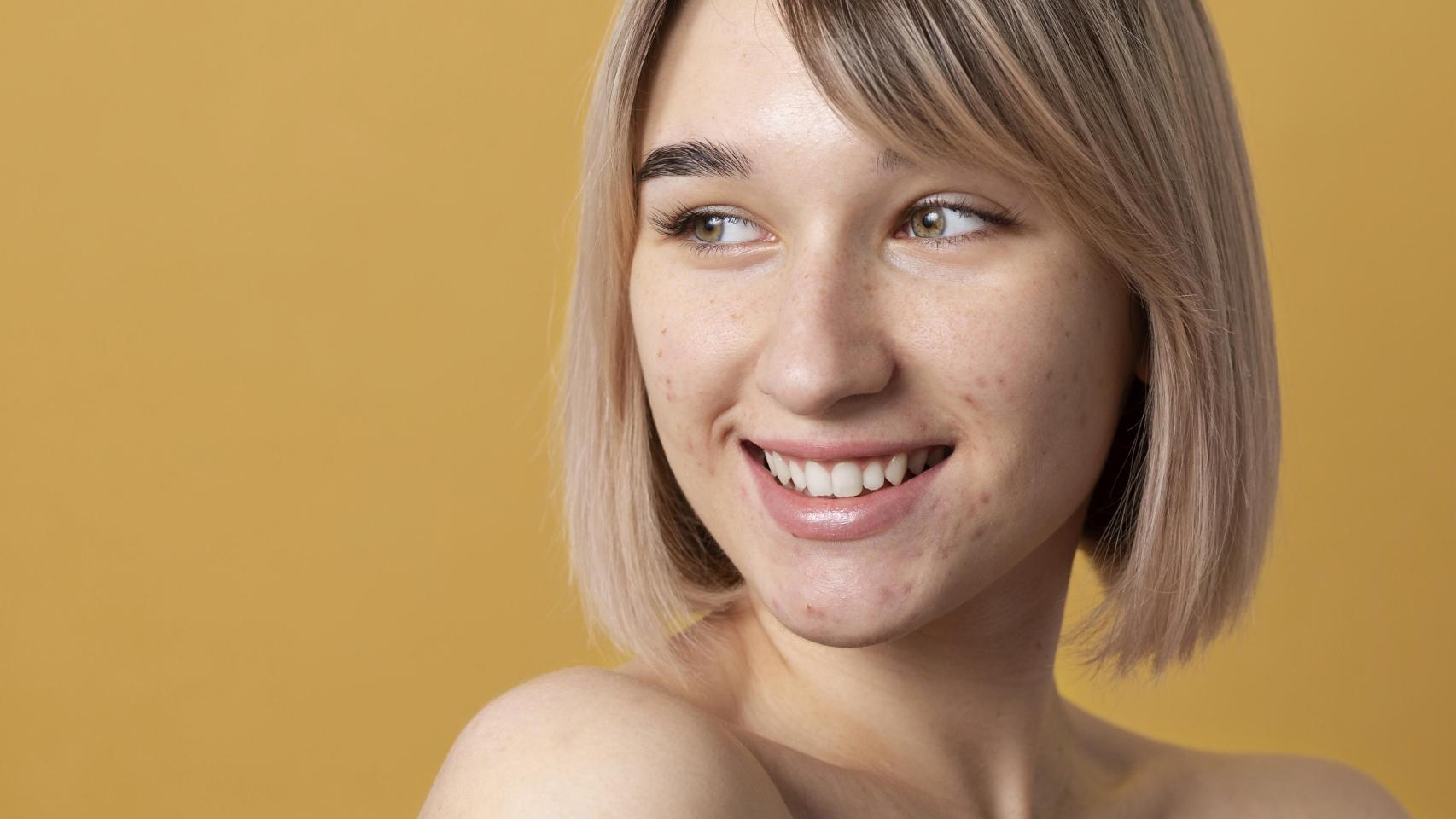 La crema correctora de L'Oréal con extracto de castaño de Indias promete disminuir manchas oscuras y marcas de acné con resultados visibles en una semana, según detalla Walmart EEUU.