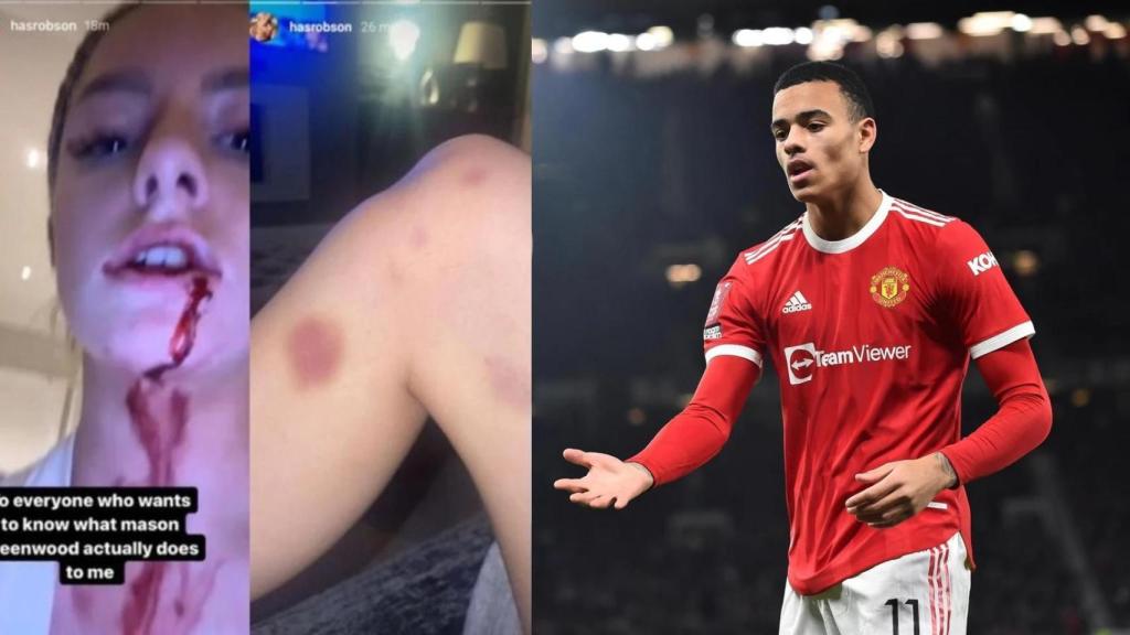 La imágenes de la pregunta agresión de Greenwood a su novia.