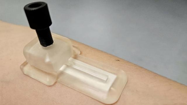 Parche para buscar biomarcadores sin pinchazos