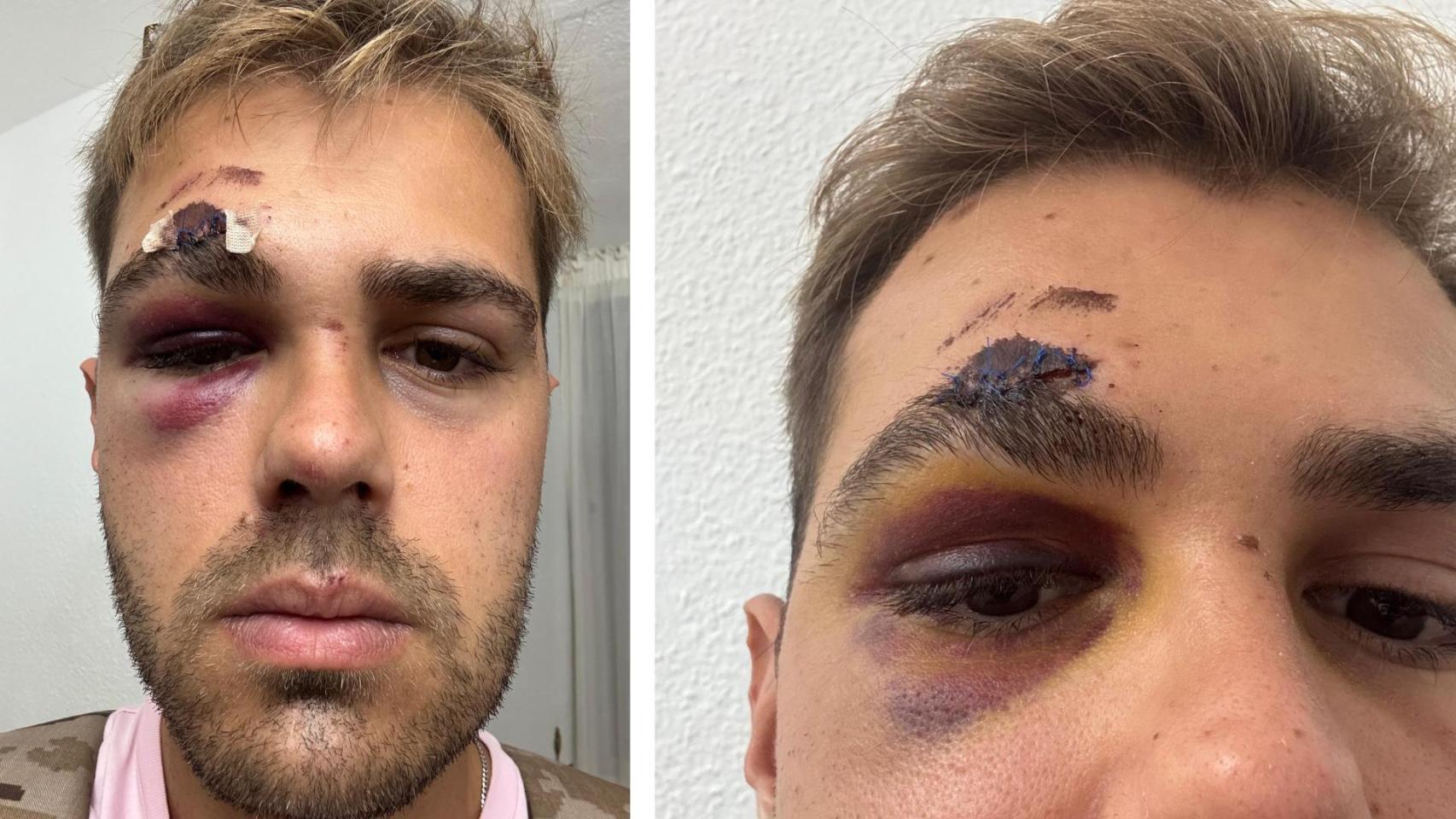 La imagen de cómo quedó su rostro.