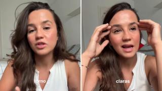 Teresa (28 años) alto y claro sobre las operaciones estéticas: "Siempre me hacían comentarios feos de mi nariz"