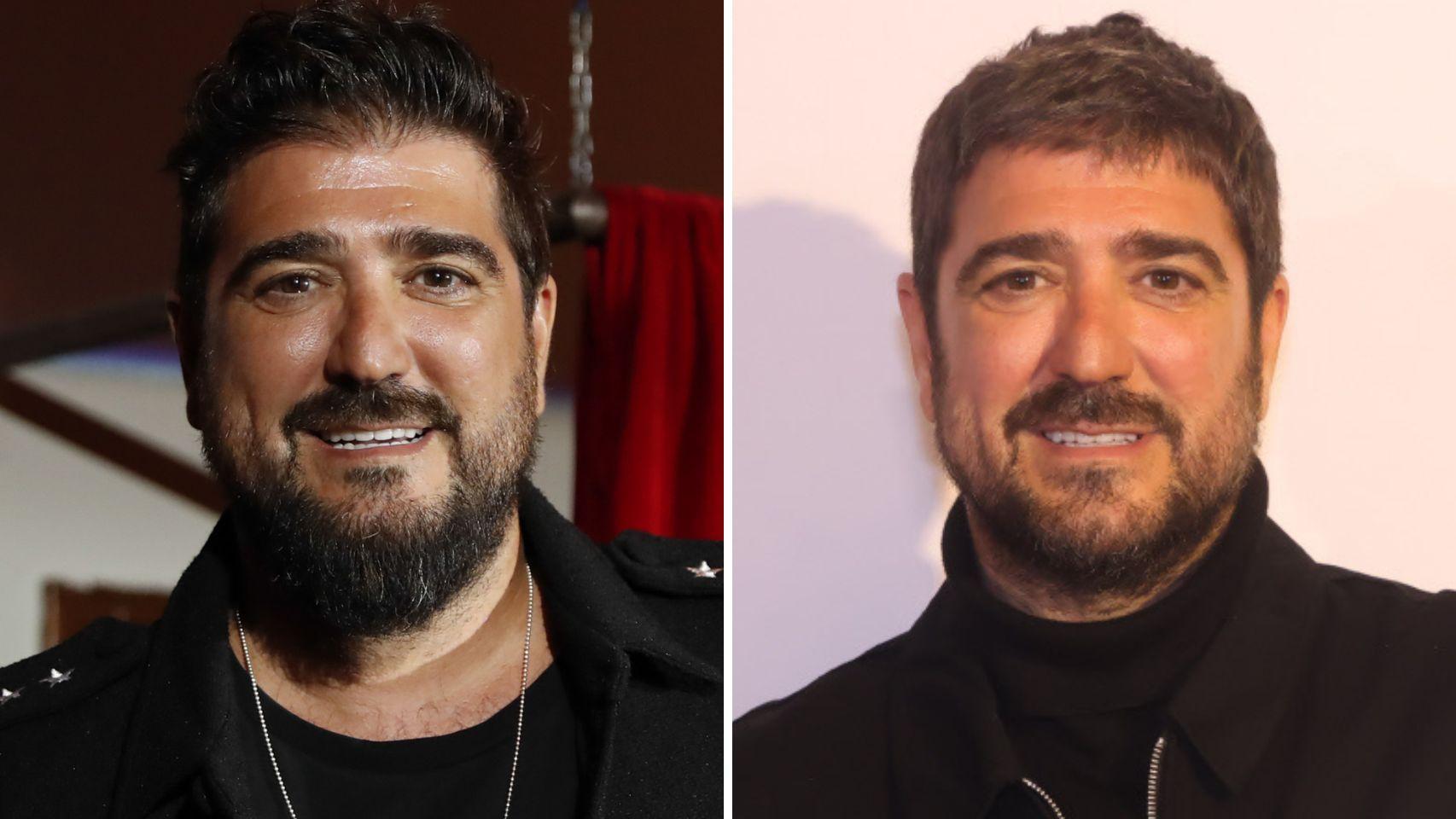 Antonio Orozco, antes y después.