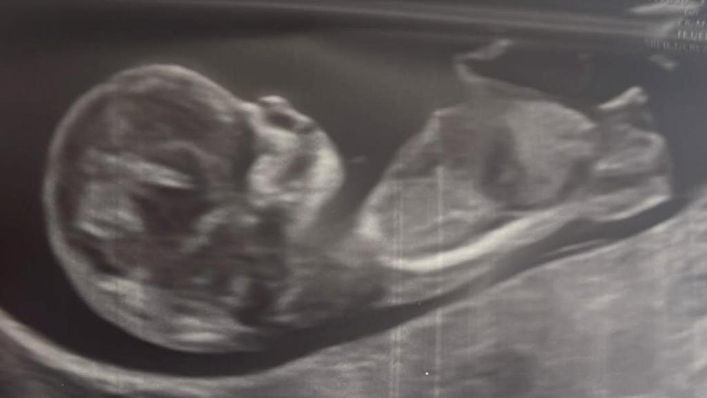 El mayor regalo que la vida nos ha hecho, escribe Alberto Herrera y Blanca Llandres al anunciar que esperan su primer hijo en común.