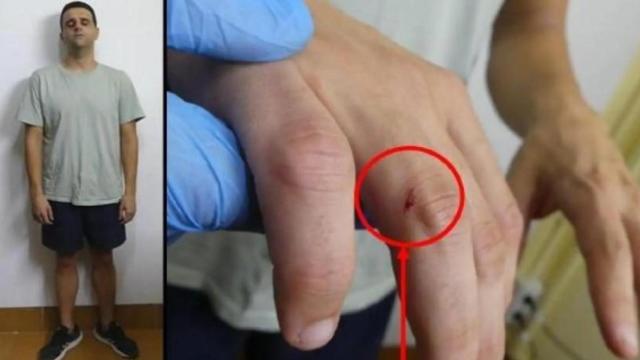 Felipe junior, tras ser detenido, junto a una imagen de su puño lesionado tras darle una paliza a su padre.