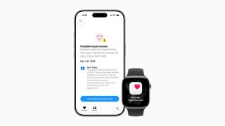 La función hipertensión del Apple Watch, aprobada por los reguladores de salud en EEUU