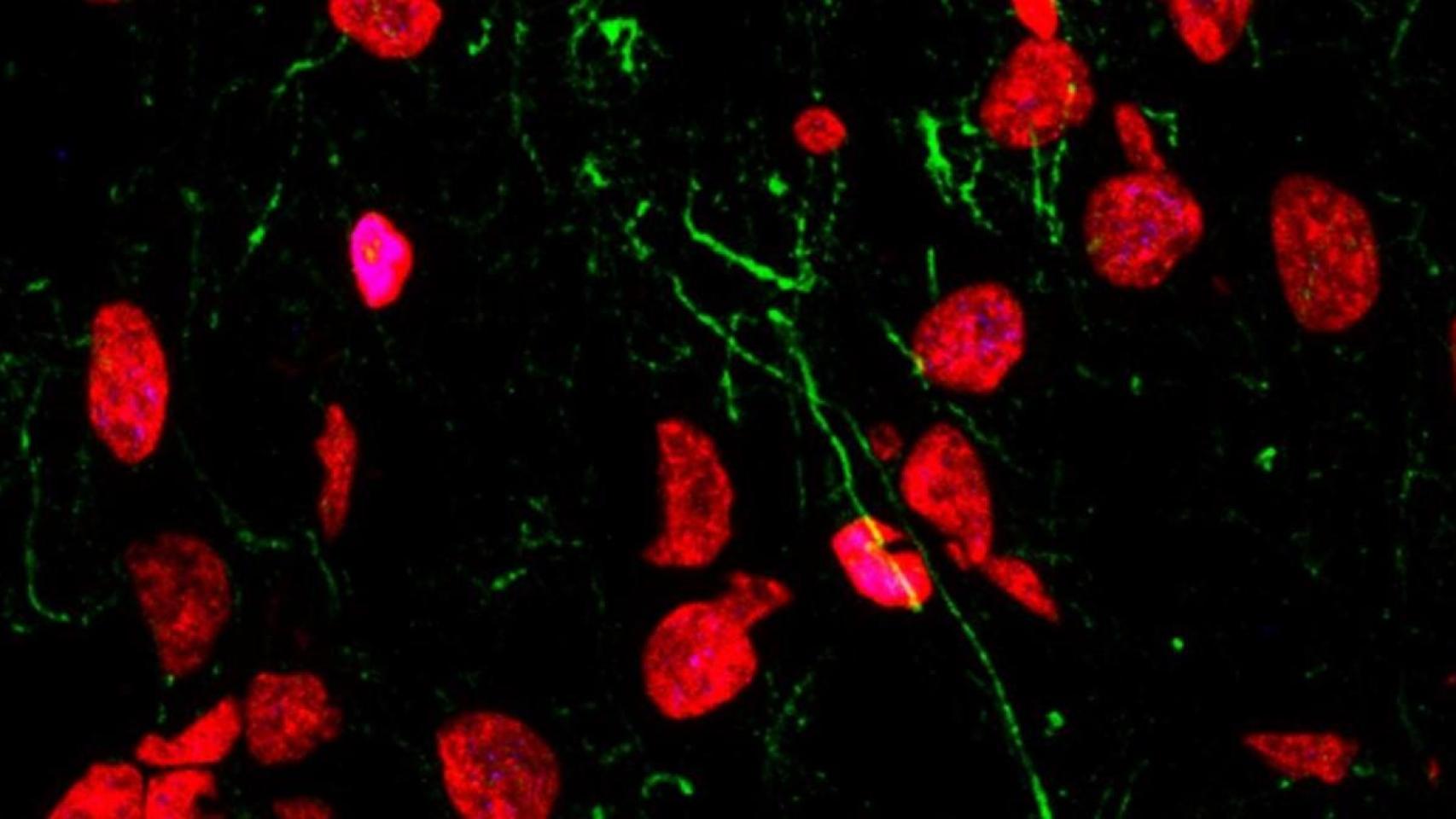 Células madre en división en el hipocampo humano adulto. / LlorensLab