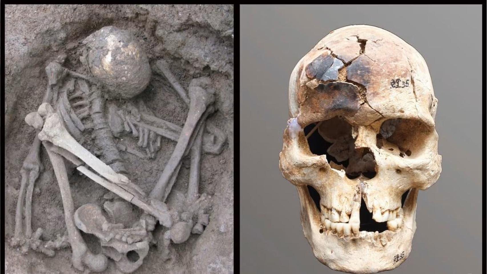 Individuo joven de sexo masculino en posición hiperflexionada (izquierda) procedente del yacimiento de Liyupo, en Guangxi (China), de hace unos 7.000 años, con el cráneo parcialmente quemado (derecha).