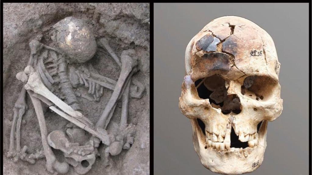 Individuo joven de sexo masculino en posición hiperflexionada (izquierda) procedente del yacimiento de Liyupo, en Guangxi (China), de hace unos 7.000 años, con el cráneo parcialmente quemado (derecha).