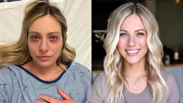 Fotografías compartidas en Facebook, por Raylee Reinhart, de Billings, Montana.