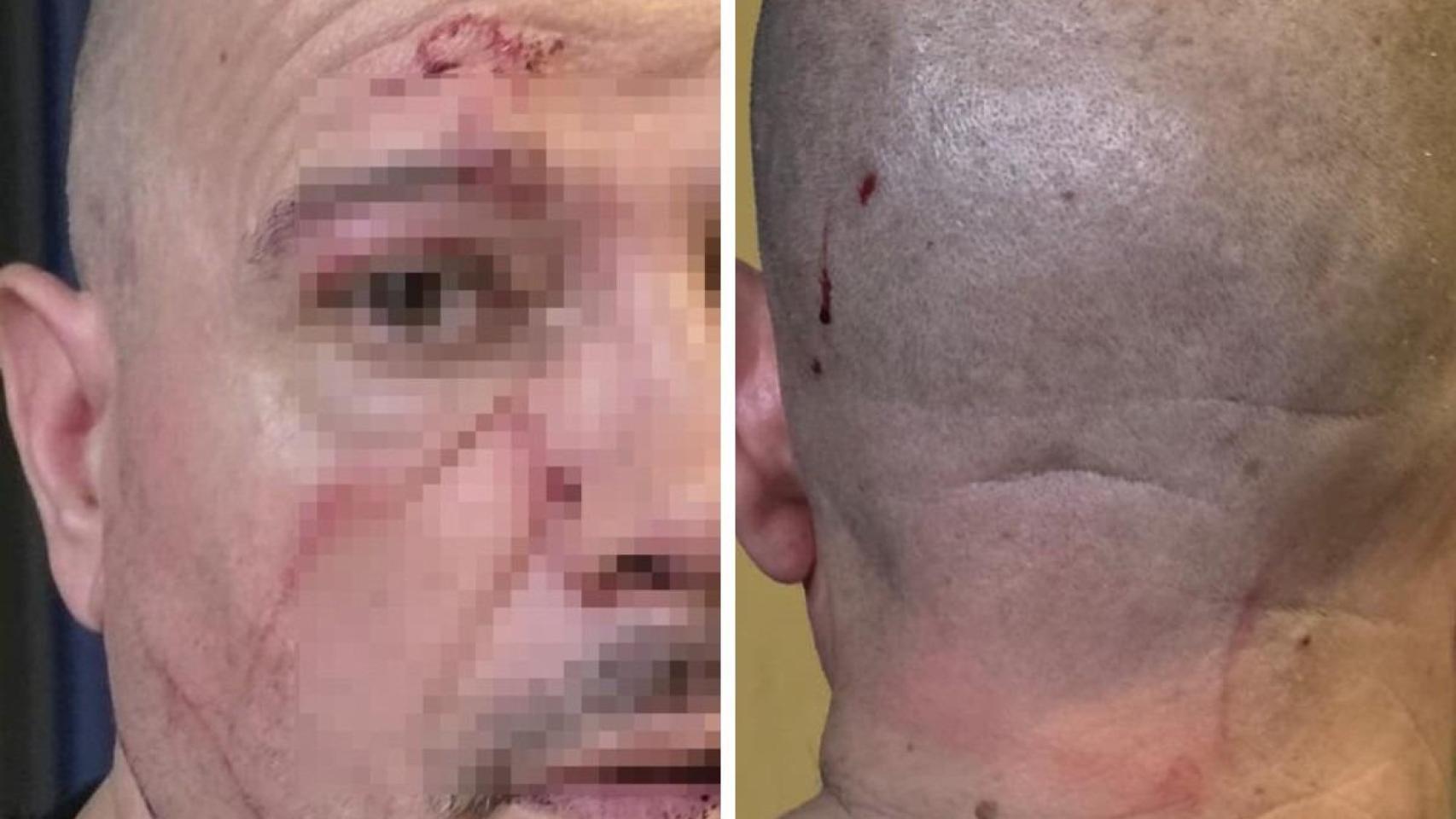 La víctima del robo.