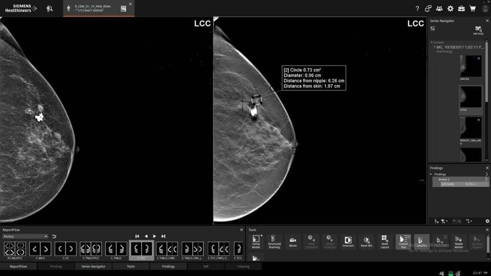 Pruebas de mama en una imagen de archivo.