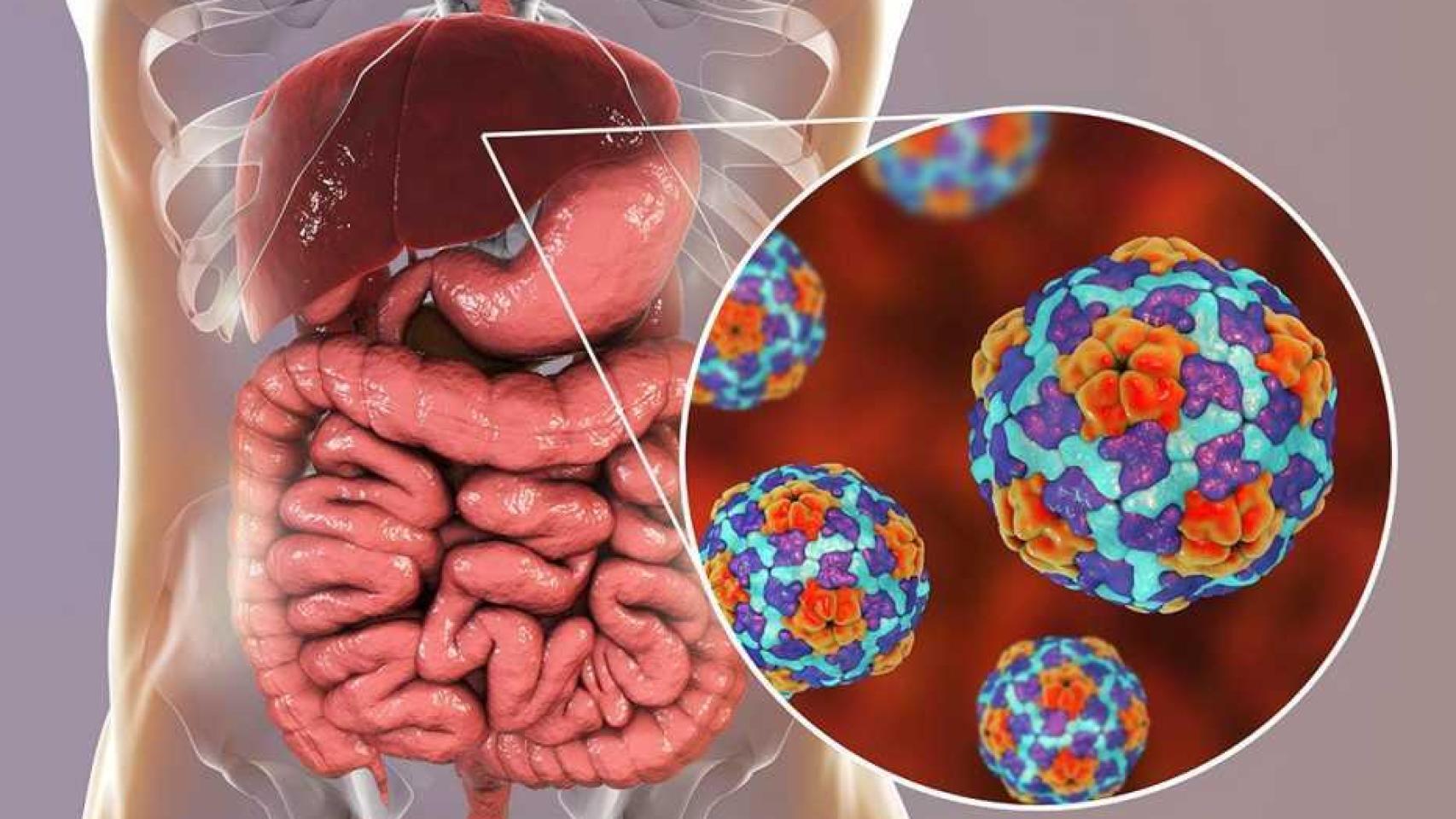 La hepatitis A provoca vómitos y malestar general.