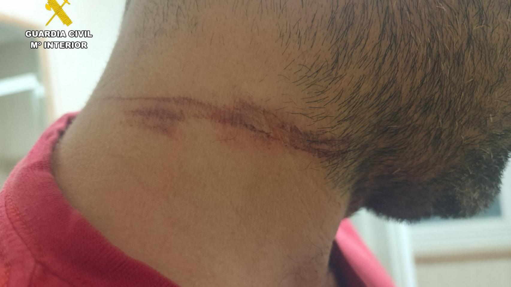 Imagen de las heridas que sufrió el motorista en el cuello en Anaya de Alba (Salamanca)