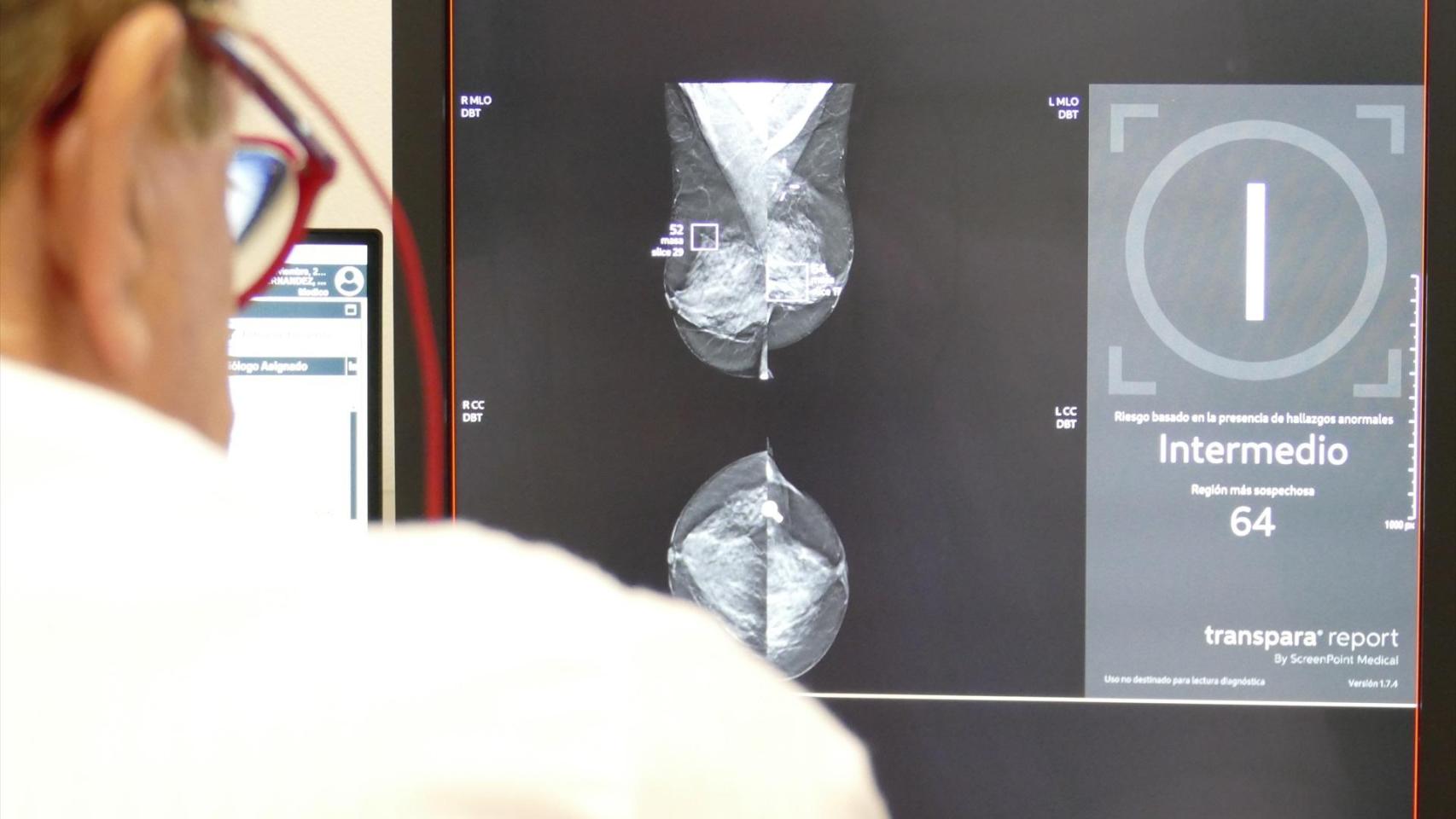 Un médico observa unas mamografías.