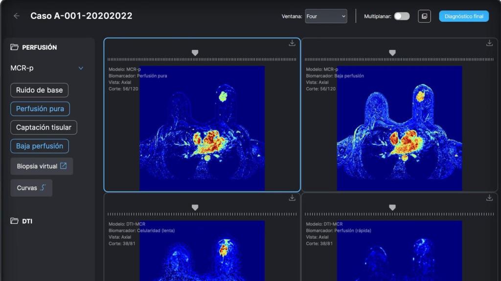 Captura de la plataforma online Kenko BreastAI+
