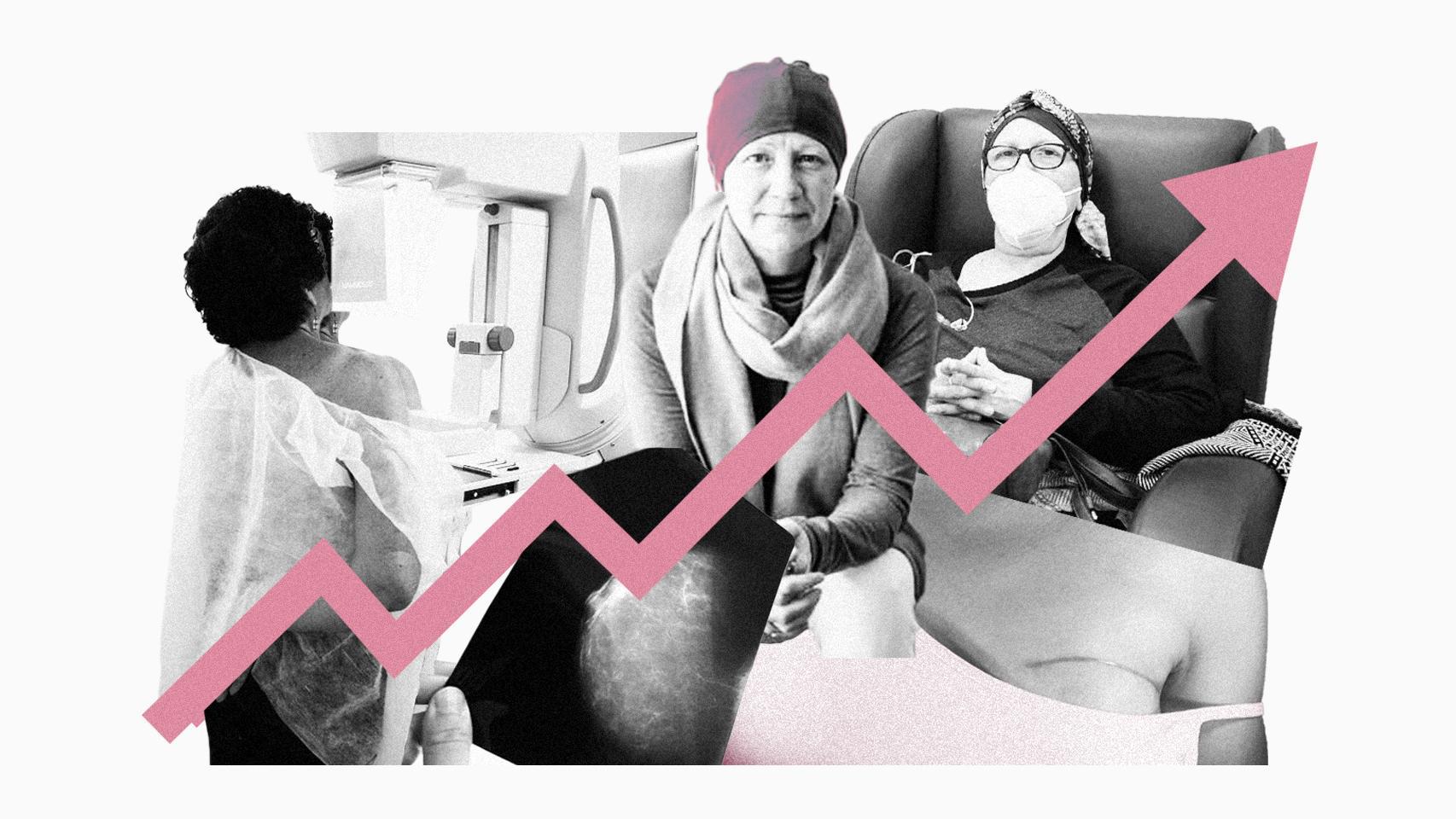 La imparable escalada del cáncer de mama en España: el número de casos aumenta un 35,8% en los últimos 10 años