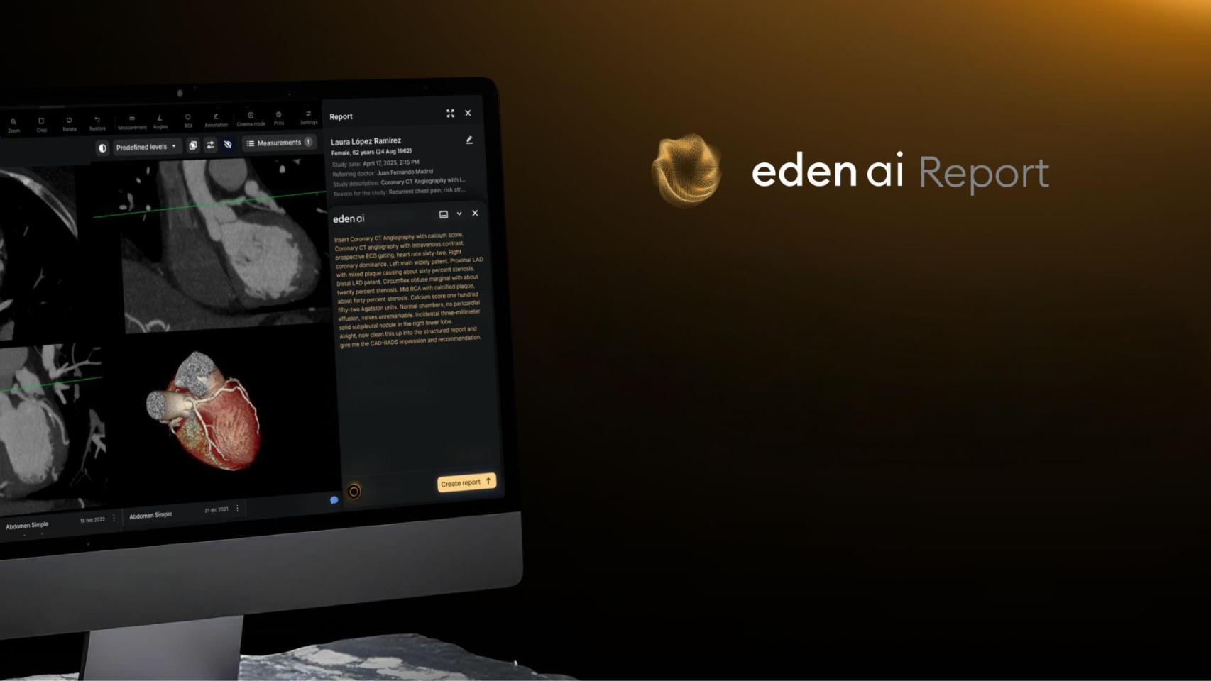 La nueva ronda permitirá a Eden expandir su herramienta de IA.