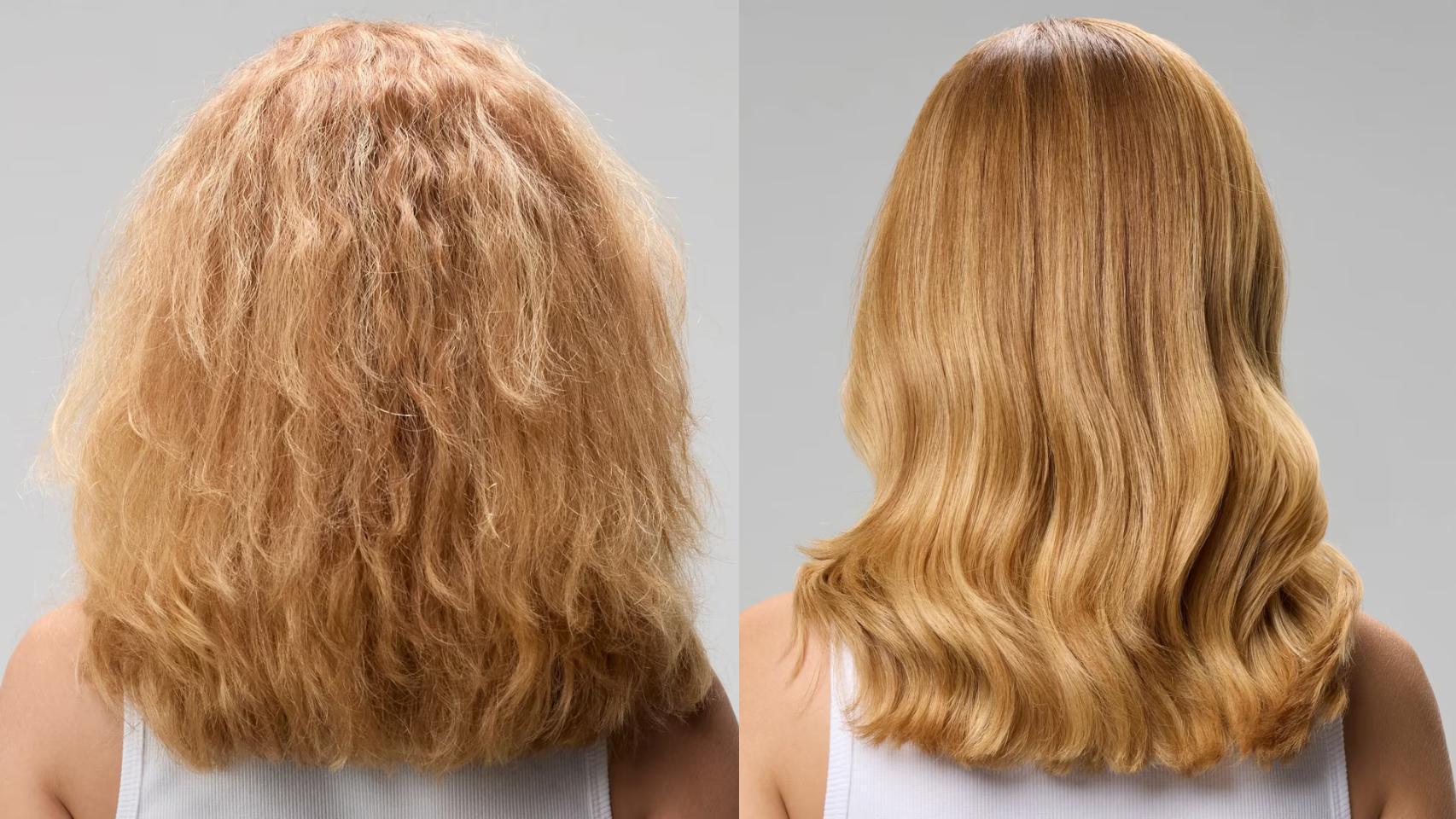 Imagen del tratamiento.