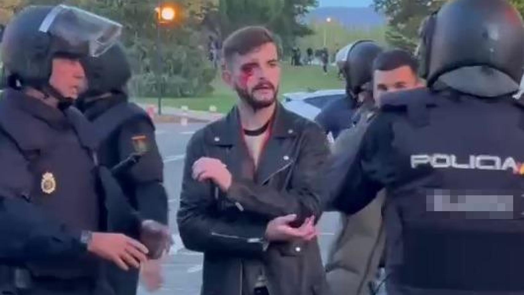 Brutal agresión de  abertzales  encapuchados al periodista de El Español que informaba de su protesta ilegal en Pamplona